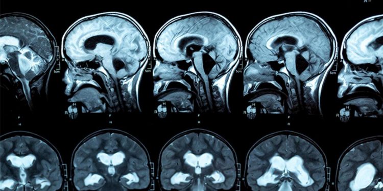 Acil hekimi mukadderatını değiştirdi… Yıllarca terapi gördü, ilaç kullandı lakin gerçek çok oburdu