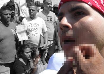 Akılalmaz protesto: Göçmenler ağızlarını dikerek açlık grevine başladı