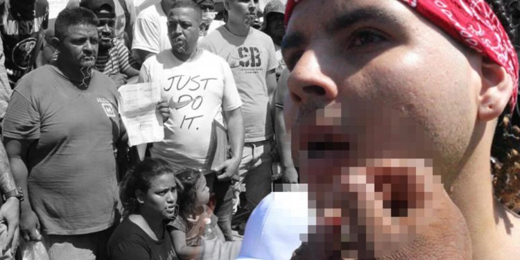 Akılalmaz protesto: Göçmenler ağızlarını dikerek açlık grevine başladı