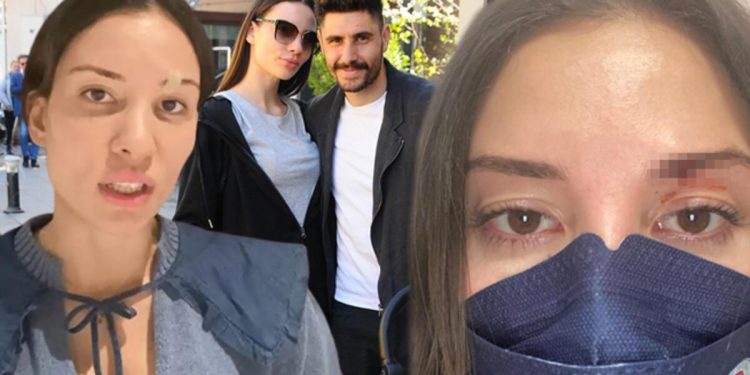 Mihriban Hurmacı’dan Özer Hurmacı’ya çekişmeli boşanma davası: 3 çocuğunun velayeti ile 20 milyon TL istedi