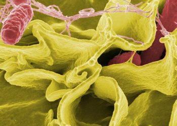 DSÖ’den Salmonella açıklaması: 6 tip antibiyotiğe dirençli!