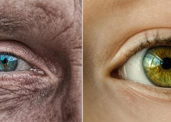 İngiltere’de şaşırtan deney: 53 yaşındaki bir bayanın cilt hücrelerini 30 yıl gençleştirildi