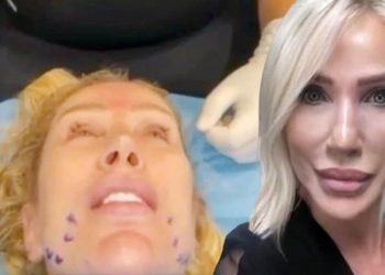 Seda Sayan nikah öncesi yüzünü gerdirdi