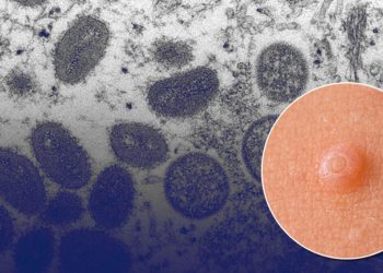 Evvel Avrupa, artık ABD… Yeni salgın dehşet yarattı!