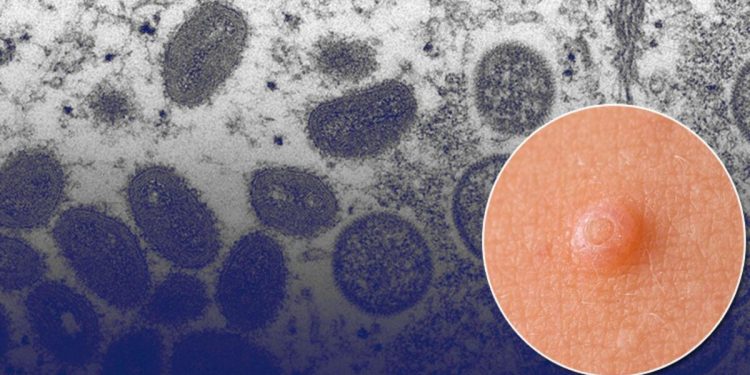 Evvel Avrupa, artık ABD… Yeni salgın dehşet yarattı!