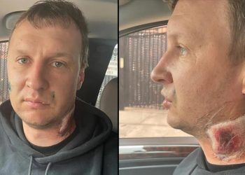 New York’ta akılalmaz olay: Ukraynalı adamı Rus sanıp dövdüler!