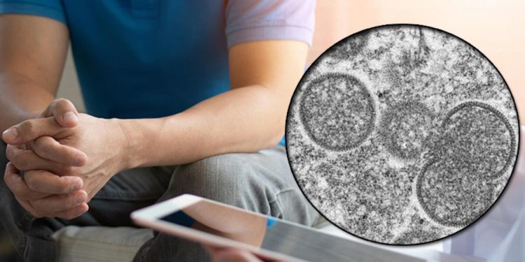 ABD ve Meksika’da panik! Maymun çiçeği teşhisi aldı, hastaneden kaçtı