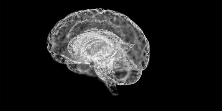 Hayatımıza pandemiyle girdi… ‘Beyin sisi’ milyonları etkiliyor!