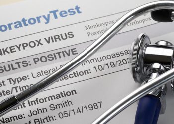 Maymun çiçeği virüsünde çarpıcı bulgular…76 gün boyunca bedenden atılmadı