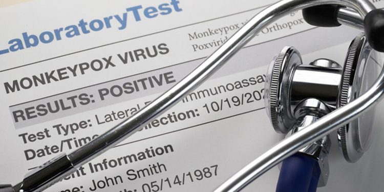 Maymun çiçeği virüsünde çarpıcı bulgular…76 gün boyunca bedenden atılmadı