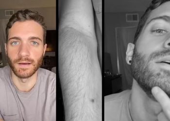 ABD’de bir birinci… Maymun Çiçeği hastalığına yakalanan aktör yaşadıklarını anlattı…